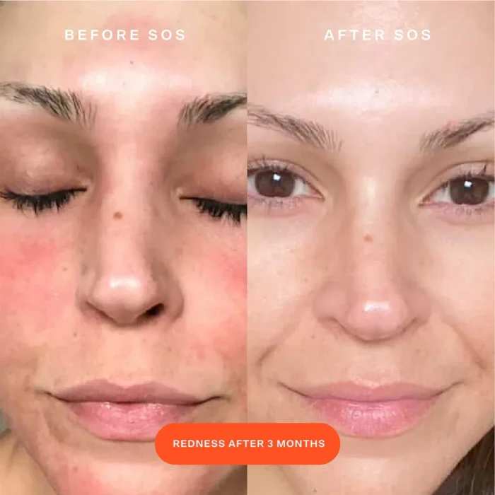 ⁦SOS Daily Rescue Facial Spray⁩ - الصورة ⁦5⁩