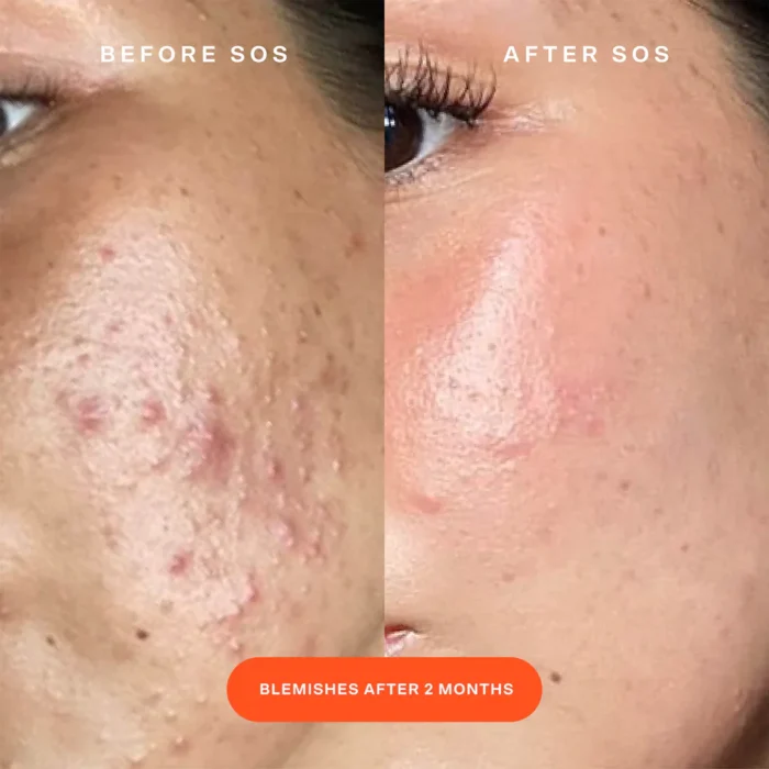 ⁦SOS Daily Rescue Facial Spray⁩ - الصورة ⁦4⁩